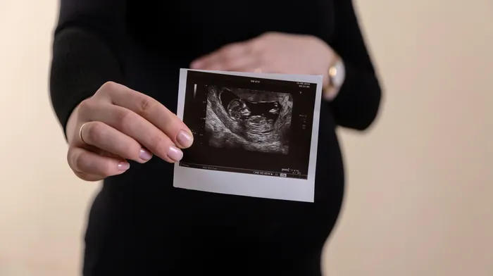 An expectant mother holding up her baby's ultrasound scan in front of her bump